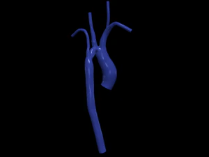 Aorte Modèle 3D