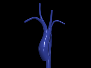 Aorta Modelo 3D