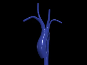 Aorte Modèle 3D
