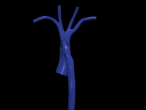 Aorta 3D Model