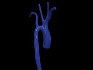 Aorta 3D Model