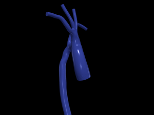 Aorta 3D Model
