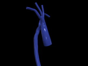 Aorta 3D Model