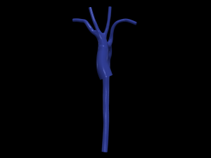 Aorta 3D Model
