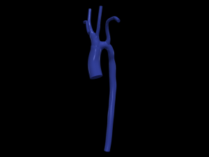 Aorta 3D Model
