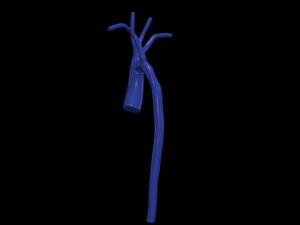 Aorta 3D Model
