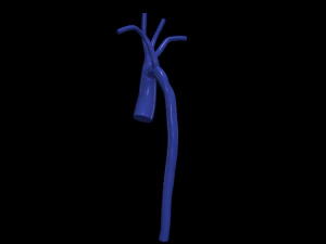 Aorta 3D Model