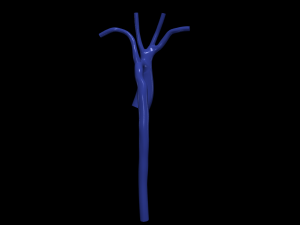 Aorta 3D Model