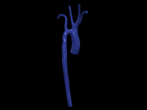 Aorta 3D Model
