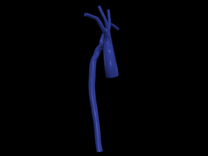 Aorta 3D Model