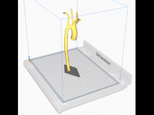 Aorta 3D Model