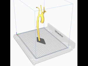 Aorta 3D Model