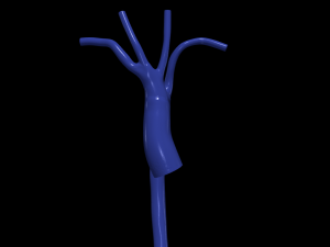 Aorta 3D Model
