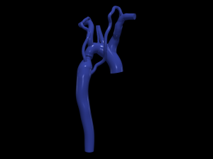 Aorta Modèle 3D