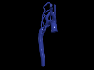 Aorta Modèle 3D