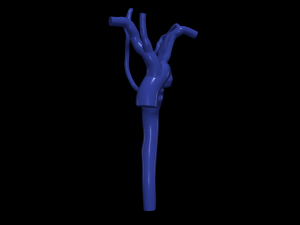 Aorta Modèle 3D