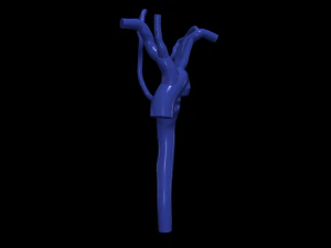 Aorta 3D Model