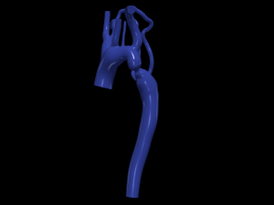 Aorta Modèle 3D