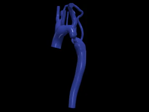 Aorta 3D Model