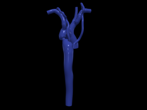 Aorta Modèle 3D