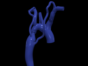 Aorta Modèle 3D