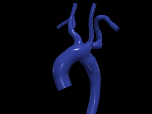 Aorta 3D Model