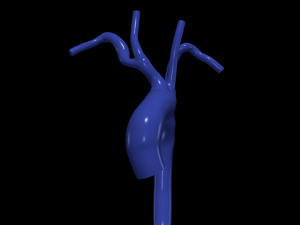 Aorta 3D 모델