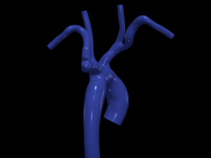 Aorta 3D 모델