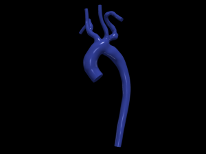 Aorta 3D 모델