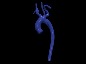 Aorta 3D Model