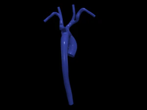 Aorta 3D Model