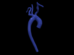 Aorta 3D 모델