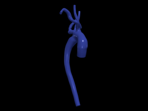 Aorta 3D 모델