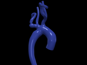 Aorta 3D 모델