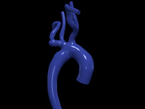 Aorta 3D Model