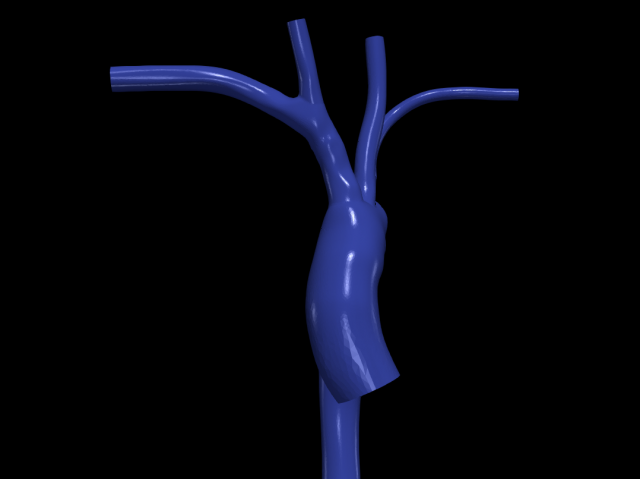 Aorta Model 3D .c4d .max .obj .3ds .fbx .stl .blend 