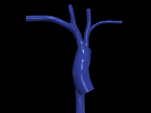 Aorta 3D Model