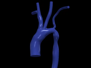 Aorta 3D Model