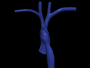 Aorta 3D Model