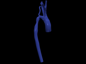Aorta Model 3D