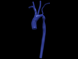 Aorta Model 3D