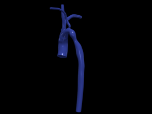 Aorta Model 3D