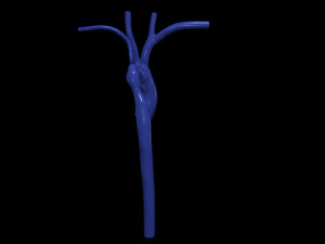 Aorta 3D Model