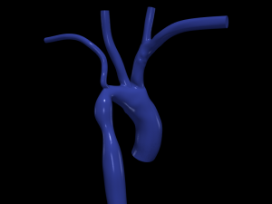 Aorta Model 3D