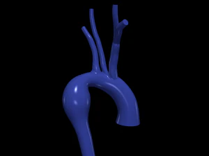 Aorta 3D Modell