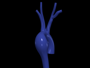 Aorta 3D Modell