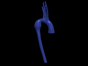 Aorta 3D Modell