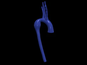 aorta Model 3D