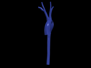Aorta 3D Modell