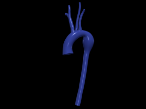 Aorta 3D Modell